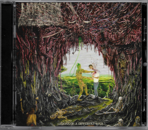 Undeath : Lesions Of A Different Kind (Album)