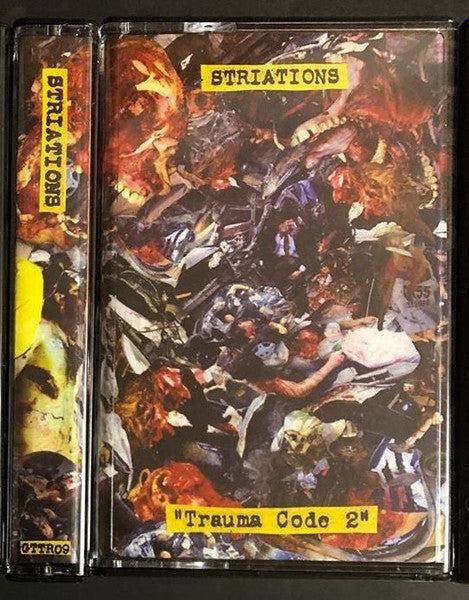 Striations : Trauma Code 2 ()