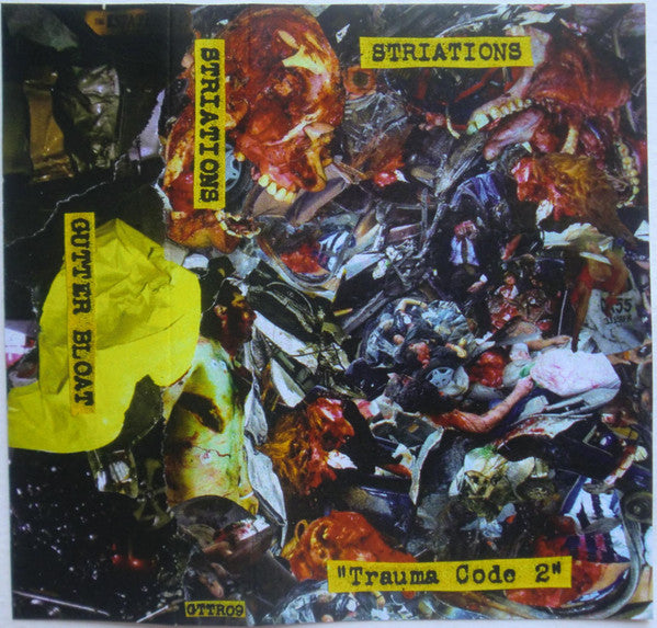 Striations : Trauma Code 2 ()