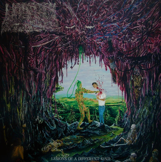 Undeath : Lesions Of A Different Kind (LP)