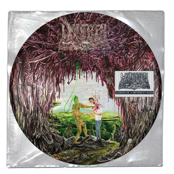 Undeath : Lesions Of A Different Kind (LP)