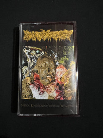 Pharmacist (3) : Medical Renditions Of Grinding Decomposition (Album)