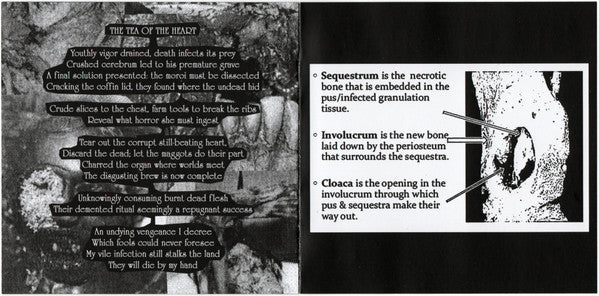 Sequestrum : The Epitome Of Putridity (EP)